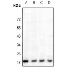 LifeSab™ Cathepsin H Rabbit pAb (50 µl)