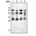 LifeSab™ Placental lactogen Rabbit pAb (50 µl)