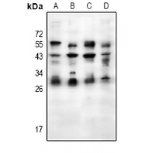 LifeSab™ Placental lactogen Rabbit pAb (50 µl)