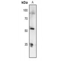 LifeSab™ p53 (pT81) Rabbit pAb (50 µl)