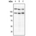 LifeSab™ c-Met (pS985) Rabbit pAb (50 µl)