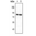 LifeSab™ FRS2 (pY196) Rabbit pAb (50 µl)