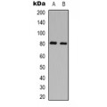 LifeSab™ PKC theta (pS695) Rabbit pAb (50 µl)