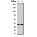 LifeSab™ Telomerase Rabbit pAb (50 µl)