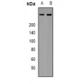 LifeSab™ p16 INK4a Rabbit pAb (50 µl)