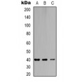 LifeSab™ GTF3C2 Rabbit pAb (50 µl)