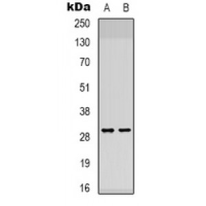 LifeSab™ B3GALTL Rabbit pAb (50 µl)