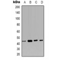 LifeSab™ CSGALNACT2 Rabbit pAb (50 µl)