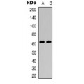 LifeSab™ DNA Polymerase mu Rabbit pAb (50 µl)