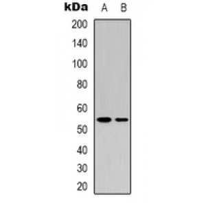 LifeSab™ p53 (AcK382) Rabbit pAb (50 µl)