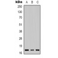 LifeSab™ HGF Rabbit pAb (50 µl)