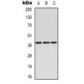 LifeSab™ CD96 Rabbit pAb (50 µl)