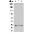 LifeSab™ VN1R2 Rabbit pAb (50 µl)