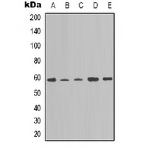 LifeSab™ Plasma Kallikrein HC Rabbit pAb (50 µl)