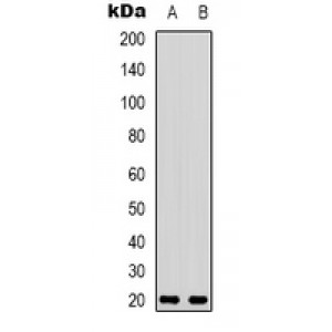 LifeSab™ p68 Rabbit pAb (50 µl)