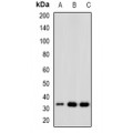 LifeSab™ CD168 Rabbit pAb (50 µl)