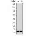 LifeSab™ MIA2 Rabbit pAb (50 µl)