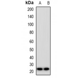 LifeSab™ MIA2 Rabbit pAb (50 µl)