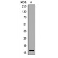 LifeSab™ NOP56 Rabbit pAb (50 µl)