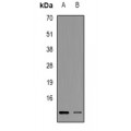 LifeSab™ CMTM6 Rabbit pAb (50 µl)