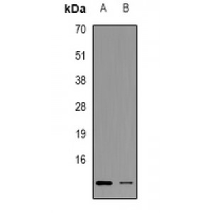 LifeSab™ CMTM6 Rabbit pAb (50 µl)