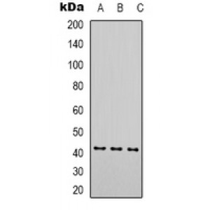 LifeSab™ Alpha-fetoglobulin Mouse mAb (50 µl)