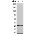 LifeSab™ Cleaved PARP1 Mouse mAb (50 µl)