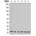 LifeSab™ Cytokeratin 17 Mouse mAb (50 µl)