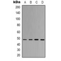 LifeSab™ ERCC1 Mouse mAb (50 µl)