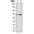 LifeSab™ HER2 Mouse mAb (50 µl)