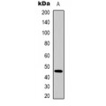 LifeSab™ E Cadherin Rabbit pAb (50 µl)