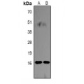 LifeSab™ Histone H3 (DiMethyl K18) Rabbit pAb (50 µl)