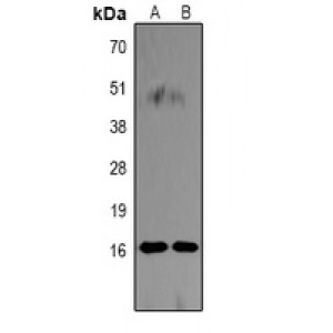 LifeSab™ Histone H3 (DiMethyl K18) Rabbit pAb (50 µl)