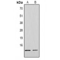 LifeSab™ Histone H4 (MonoMethyl R3) Rabbit pAb (50 µl)