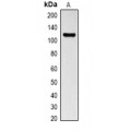 LifeSab™ MeCP2 Rabbit pAb (50 µl)