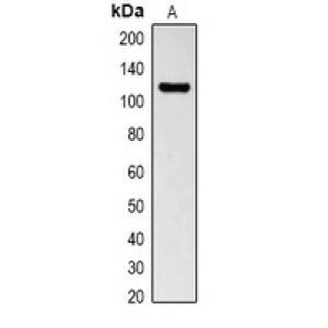 LifeSab™ MeCP2 Rabbit pAb (50 µl)