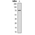 LifeSab™ PI3K p85 alpha Rabbit pAb (50 µl)