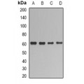 LifeSab™ UGT1A1 Rabbit pAb (50 µl)