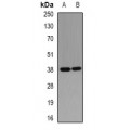 LifeSab™ PHYH Rabbit pAb (50 µl)