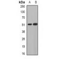 LifeSab™ MGAT1 Rabbit pAb (50 µl)