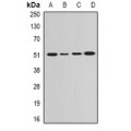 LifeSab™ GDA Rabbit pAb (50 µl)