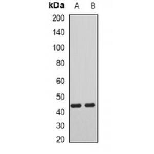 LifeSab™ AIPL1 Rabbit pAb (50 µl)