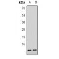 LifeSab™ AHSP Rabbit pAb (50 µl)