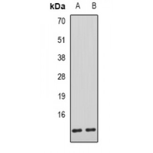 LifeSab™ AHSP Rabbit pAb (50 µl)