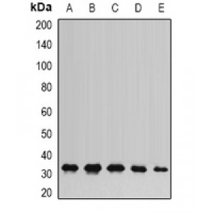 LifeSab™ AK2 Rabbit pAb (50 µl)