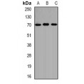 LifeSab™ ALAS-H Rabbit pAb (50 µl)