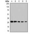 LifeSab™ NNMT Rabbit pAb (50 µl)