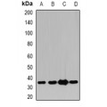 LifeSab™ Pyridoxal Kinase Rabbit pAb (50 µl)