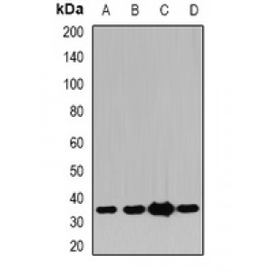 LifeSab™ Pyridoxal Kinase Rabbit pAb (50 µl)