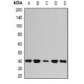 LifeSab™ PSAT1 Rabbit pAb (50 µl)